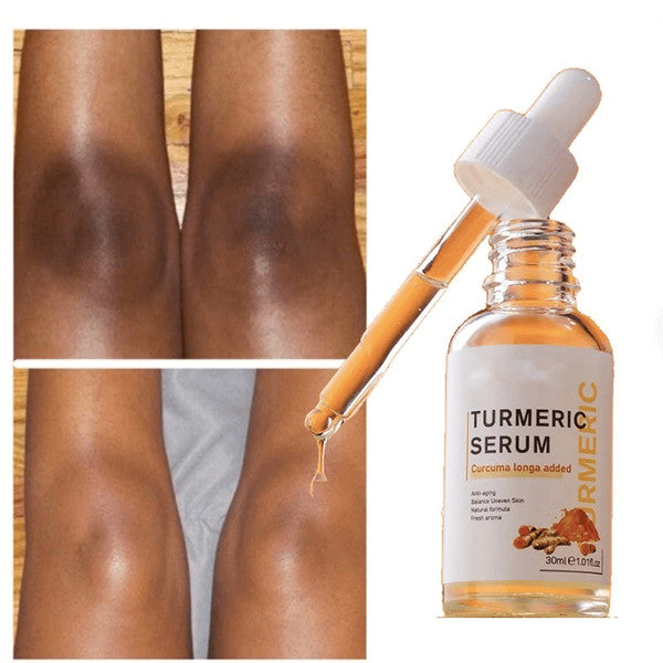 Turmeric Dark Spot Remover Serum