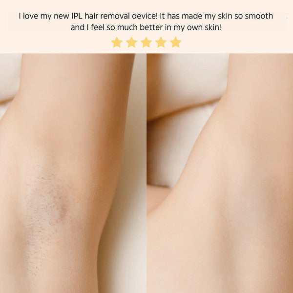PL Laser Hair Removal Handset System – Painless and Safe for All Skin Types, Perfect for Home Use