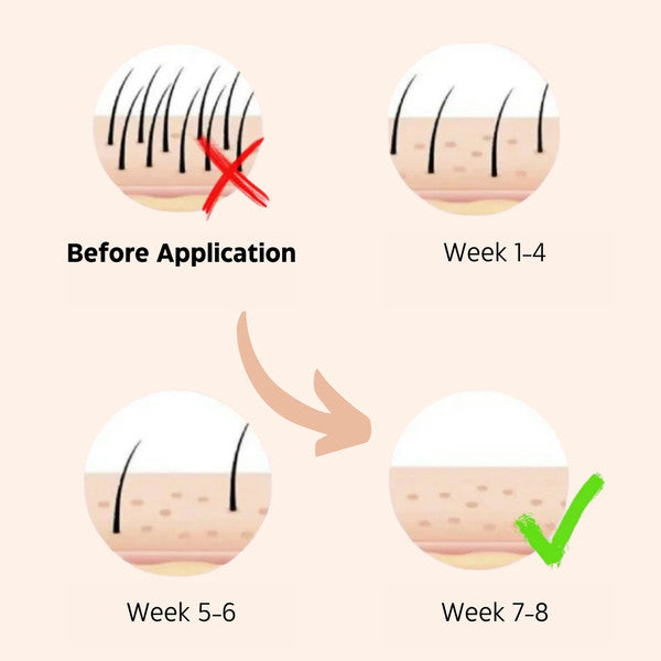 PL Laser Hair Removal Handset System – Painless and Safe for All Skin Types, Perfect for Home Use